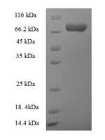 Recombinant Human Autophagy-related protein 16-1 (ATG16L1) – Figure 1 of 1