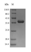(Tris-Glycine gel) Discontinuous SDS-PAGE (reduced) with 5% enrichment gel and 15% separation gel.