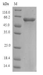 (Tris-Glycine gel) Discontinuous SDS-PAGE (reduced) with 5% enrichment gel and 15% separation gel.