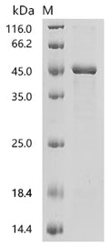 (Tris-Glycine gel) Discontinuous SDS-PAGE (reduced) with 5% enrichment gel and 15% separation gel.