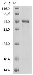 (Tris-Glycine gel) Discontinuous SDS-PAGE (reduced) with 5% enrichment gel and 15% separation gel.