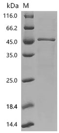 (Tris-Glycine gel) Discontinuous SDS-PAGE (reduced) with 5% enrichment gel and 15% separation gel.
