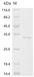 (Tris-Glycine gel) Discontinuous SDS-PAGE (reduced) with 5% enrichment gel and 15% separation gel.