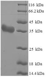 (Tris-Glycine gel) Discontinuous SDS-PAGE (reduced) with 5% enrichment gel and 15% separation gel.