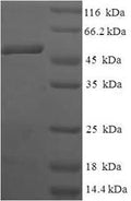 Recombinant Human Anamorsin (CIAPIN1) – Figure 1 of 1