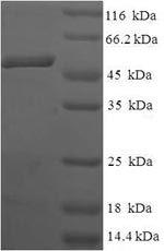 Recombinant Human Anamorsin (CIAPIN1) – Figure 1 of 1