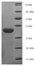 (Tris-Glycine gel) Discontinuous SDS-PAGE (reduced) with 5% enrichment gel and 15% separation gel.
