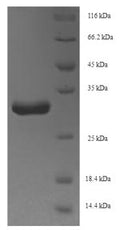 Recombinant Staphylococcus aureus Holo-[acyl-carrier-protein] synthase (acpS) – Figure 1 of 1