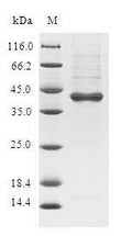(Tris-Glycine gel) Discontinuous SDS-PAGE (reduced) with 5% enrichment gel and 15% separation gel.