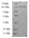 Recombinant Human Kynurenine--oxoglutarate transaminase 3 (CCBL2) – Figure 1 of 1