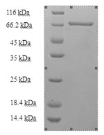 Recombinant Human Kynurenine--oxoglutarate transaminase 3 (CCBL2) – Figure 1 of 1