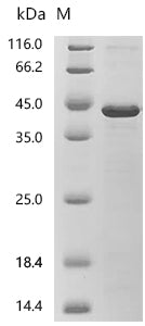 (Tris-Glycine gel) Discontinuous SDS-PAGE (reduced) with 5% enrichment gel and 15% separation gel.