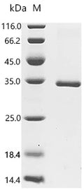 (Tris-Glycine gel) Discontinuous SDS-PAGE (reduced) with 5% enrichment gel and 15% separation gel.