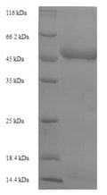 Recombinant Plasmodium falciparum Plasmepsin I (PMI) – Figure 1 of 1