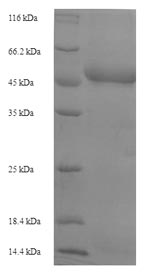 Recombinant Plasmodium falciparum Plasmepsin I (PMI) – Figure 1 of 1