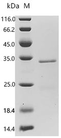 (Tris-Glycine gel) Discontinuous SDS-PAGE (reduced) with 5% enrichment gel and 15% separation gel.