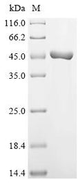 (Tris-Glycine gel) Discontinuous SDS-PAGE (reduced) with 5% enrichment gel and 15% separation gel.