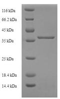 Recombinant Human Lysozyme-like protein 1 (LYZL1) – Figure 1 of 1