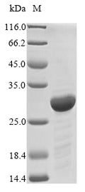 (Tris-Glycine gel) Discontinuous SDS-PAGE (reduced) with 5% enrichment gel and 15% separation gel.