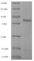 Recombinant Staphylococcus aureus Enoyl-[acyl-carrier-protein] reductase [NADPH] FabI (fabI) – Figure 1 of 1