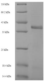 Recombinant Staphylococcus aureus Enoyl-[acyl-carrier-protein] reductase [NADPH] FabI (fabI) – Figure 1 of 1
