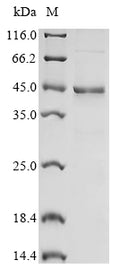 (Tris-Glycine gel) Discontinuous SDS-PAGE (reduced) with 5% enrichment gel and 15% separation gel.