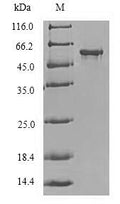 Recombinant Human Protein delta homolog 2 (DLK2), partial – Figure 1 of 1