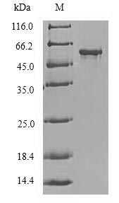 Recombinant Human Protein delta homolog 2 (DLK2), partial – Figure 1 of 1