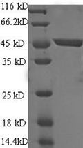 Recombinant Human Immunoglobulin-like domain-containing receptor 2 (ILDR2), partial – Figure 1 of 1