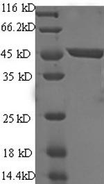 Recombinant Human Immunoglobulin-like domain-containing receptor 2 (ILDR2), partial – Figure 1 of 1
