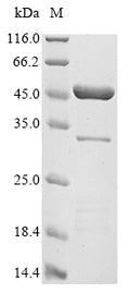 (Tris-Glycine gel) Discontinuous SDS-PAGE (reduced) with 5% enrichment gel and 15% separation gel.