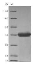 (Tris-Glycine gel) Discontinuous SDS-PAGE (reduced) with 5% enrichment gel and 15% separation gel.
