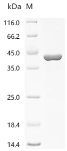 (Tris-Glycine gel) Discontinuous SDS-PAGE (reduced) with 5% enrichment gel and 15% separation gel.