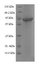 Recombinant Human Sesquipedalian-2 (FAM109B) – Figure 1 of 1
