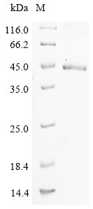 (Tris-Glycine gel) Discontinuous SDS-PAGE (reduced) with 5% enrichment gel and 15% separation gel.