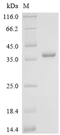 (Tris-Glycine gel) Discontinuous SDS-PAGE (reduced) with 5% enrichment gel and 15% separation gel.