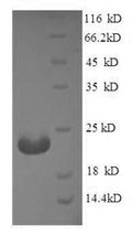 Recombinant Human Angiopoietin-like protein 8 (ANGPTL8) – Figure 1 of 1