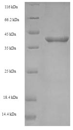 Recombinant Listeria monocytogenes serotype 4b Internalin-A (inlA), partial – Figure 1 of 1