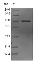 (Tris-Glycine gel) Discontinuous SDS-PAGE (reduced) with 5% enrichment gel and 15% separation gel.