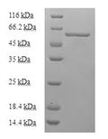 Recombinant Mouse Uncharacterized aarF domain-containing protein kinase 2 (Adck2), partial – Figure 1 of 1