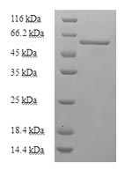 Recombinant Mouse Uncharacterized aarF domain-containing protein kinase 2 (Adck2), partial – Figure 1 of 1