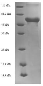 Recombinant Zaire ebolavirus Matrix protein VP40 (VP40) – Figure 1 of 1