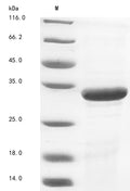 (Tris-Glycine gel) Discontinuous SDS-PAGE (reduced) with 5% enrichment gel and 15% separation gel.
