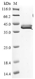 (Tris-Glycine gel) Discontinuous SDS-PAGE (reduced) with 5% enrichment gel and 15% separation gel.