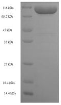 Recombinant Human Keratin, type II cytoskeletal 1b (KRT77) – Figure 1 of 1