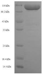 Recombinant Human Keratin, type II cytoskeletal 1b (KRT77) – Figure 1 of 1