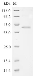 (Tris-Glycine gel) Discontinuous SDS-PAGE (reduced) with 5% enrichment gel and 15% separation gel.