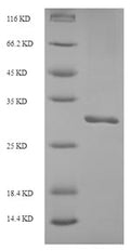 Recombinant Human Inter-alpha-trypsin inhibitor heavy chain H5 (ITIH5), partial – Figure 1 of 1