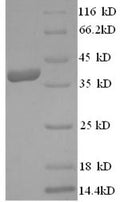 Recombinant Human Ly6/PLAUR domain-containing protein 6 (LYPD6) – Figure 1 of 1