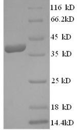 Recombinant Human Ly6/PLAUR domain-containing protein 6 (LYPD6) – Figure 1 of 1